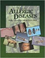 Atlas of Allergic Diseases, (157340182X), Phillip L. Lieberman 
