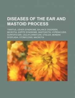  of the Ear and Mastoid Process Tinnitus, Usher Syndrome, Balance 