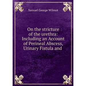   Perineal Abscess, Urinary Fistula and . Samuel George Wilmot Books