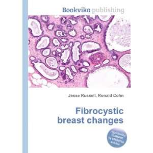    Fibrocystic breast changes Ronald Cohn Jesse Russell Books