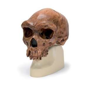  Anthropological Skull Model   Broken Hill or Kabwe Health 