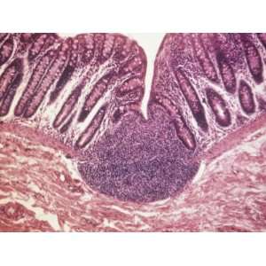 Cross Section of Peyers Patch in the Large Intestine Photographic 