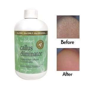   Natural Callus Eliminator Foot Treatment 4oz